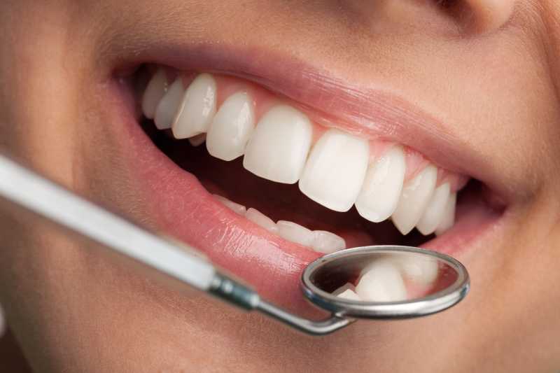 干净洁白的牙齿接受牙齿检查