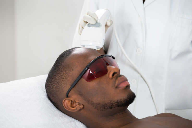 治疗师正在对非洲男子做激光脱毛