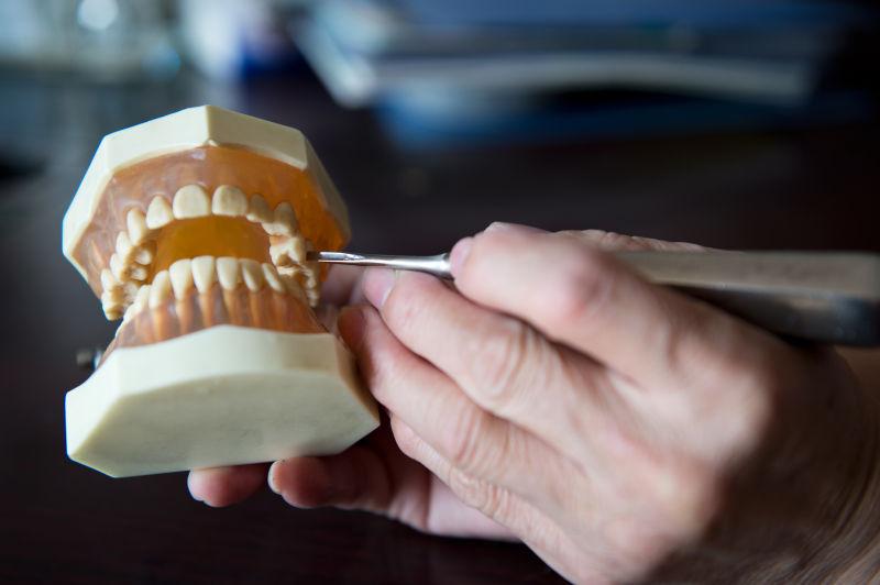 牙医持牙齿模型