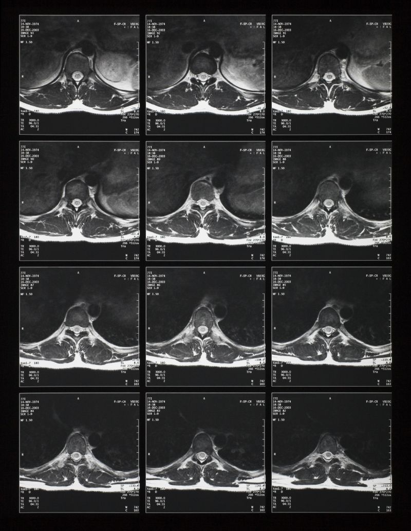 人类颅骨X光透析图