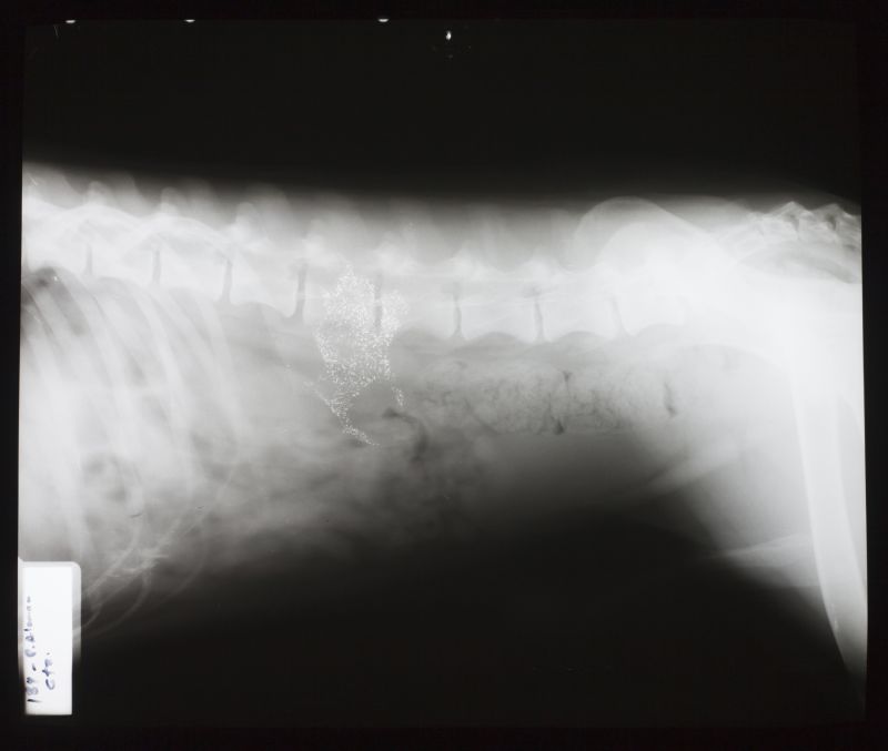 人体侧面脊椎关节x射线片子