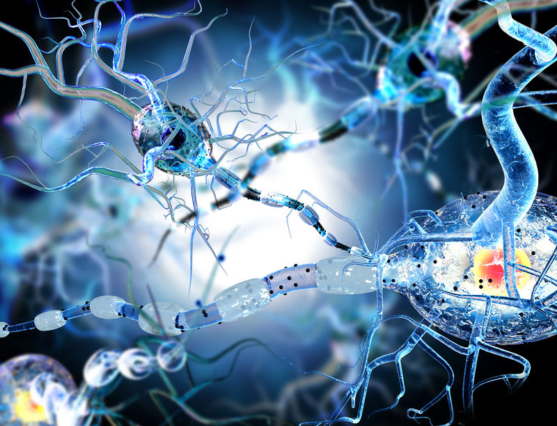 神经细胞的三维图解-神经疾病、肿瘤和脑外科的概念