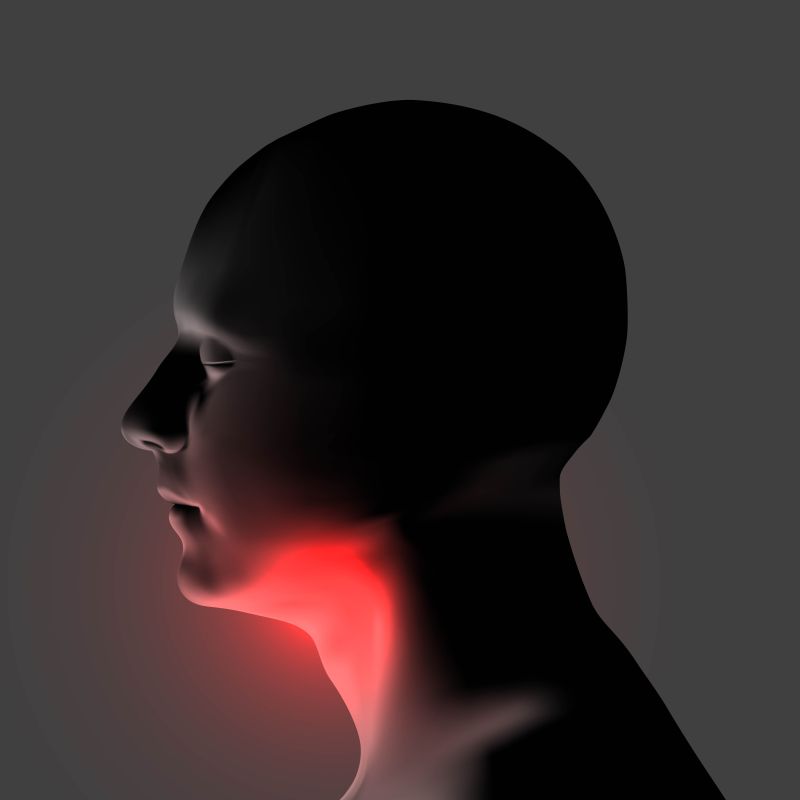 喉咙发炎概念矢量插画